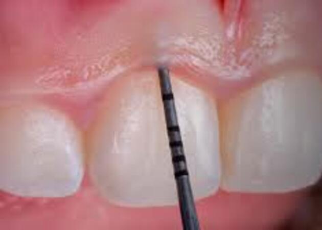 Galería de imágenes OSTOS PELAYO (CLÍNICA DENTAL) 1