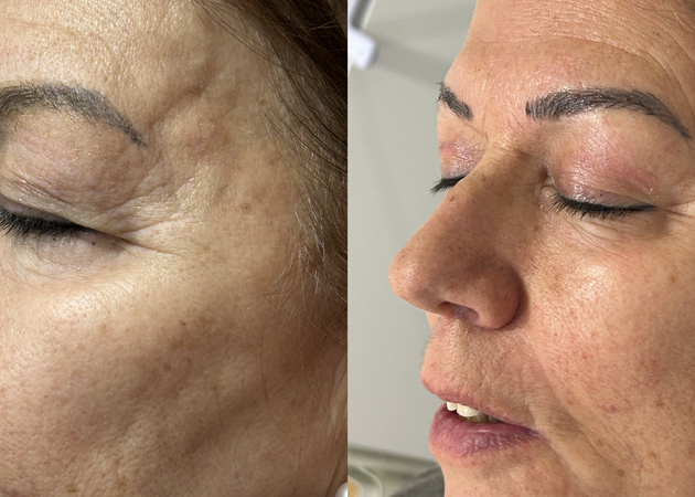 Galería de imágenes REVIVE ESTETICA MEDICA 1